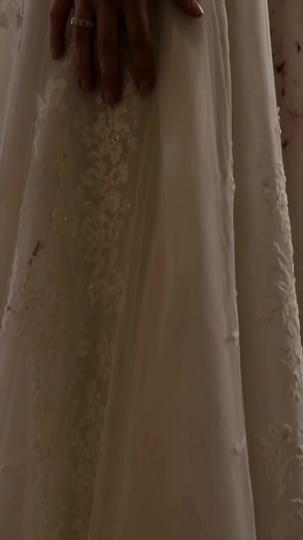 Fiancé Made Me a Bald Bride to Please His Ex Episode 8
