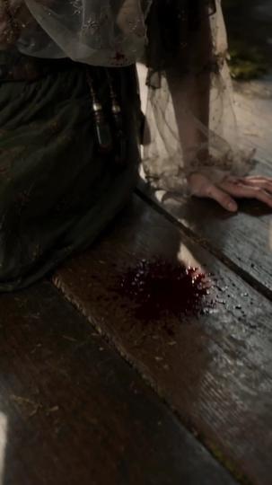 Bound by His Pain Episode 2