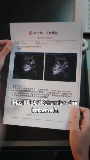 Cinta Tersembunyi di Kantor Episode 1